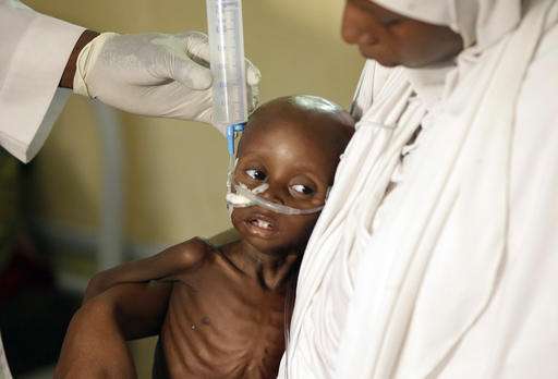 UNICEF: 80,000 children will starve to death in Nigeria