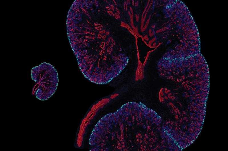 USC researchers discover a key difference between mouse and human kidney cells