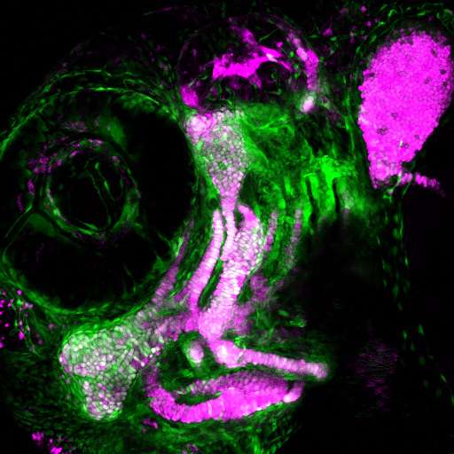 USC study shows how skeletal stem cells form the blueprint of the face
