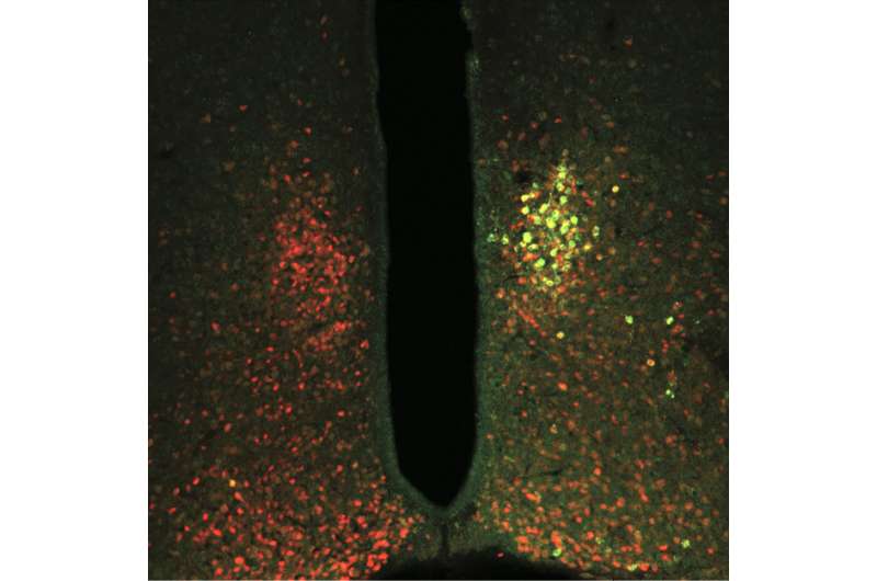 Using magnetic forces to control neurons, study finds brain is vital in glucose metabolism