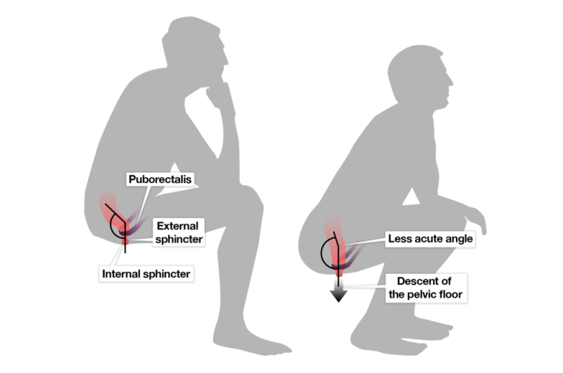 What’s the best way to go to the toilet – squatting or sitting?