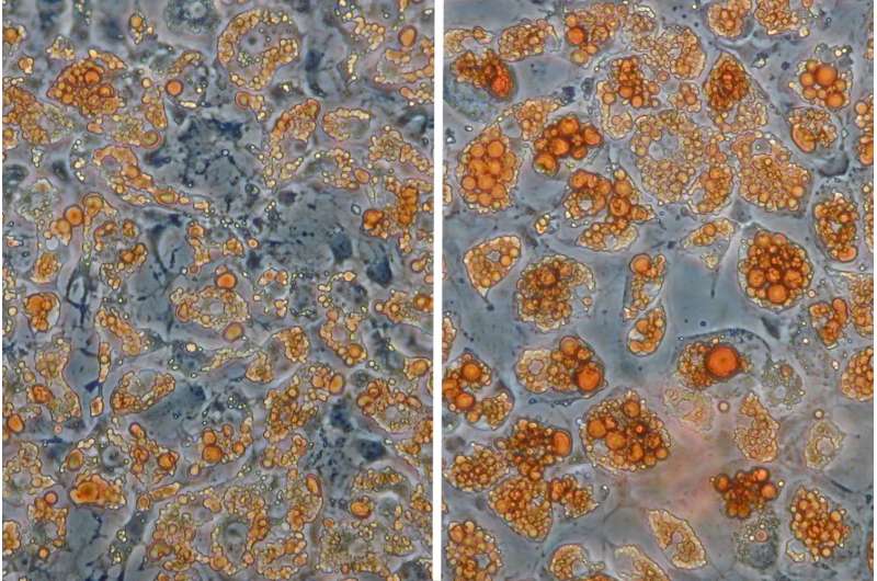 When fat cells change their color