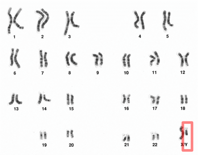 Why is the X chromosome so odd? Traffic analogy helped us crack the mystery