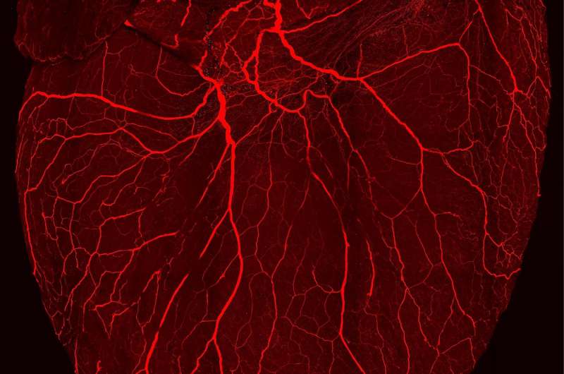 With $8.6 million grant from NIH, UCLA-led consortium will map the heart's nervous system