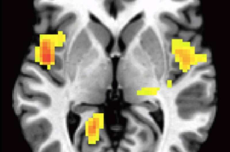 Withdrawn children display predictable brain activity during social interactions