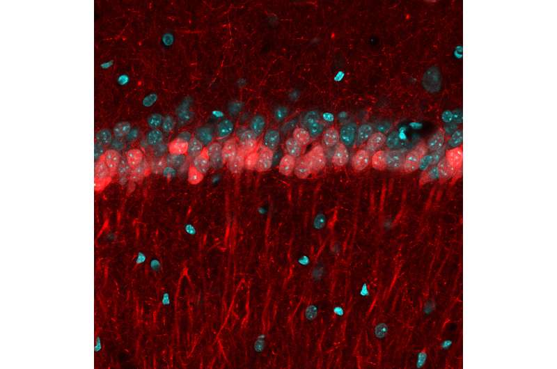 X marks the spot: Imaging study in mice sheds light on how the brain draws a map to a destination