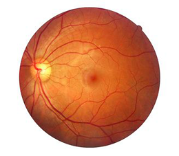 Yin and yang in retinal degeneration