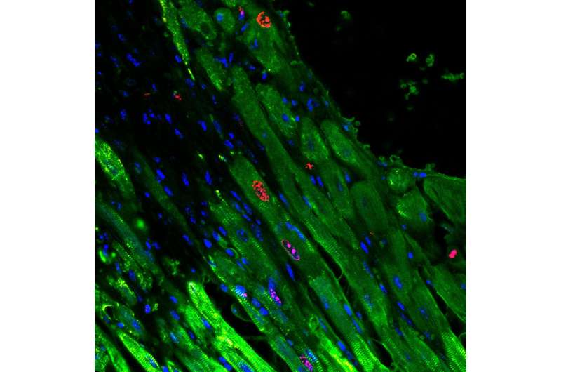 Penn researchers: An injectable gel that helps heart muscle regenerate after heart attack