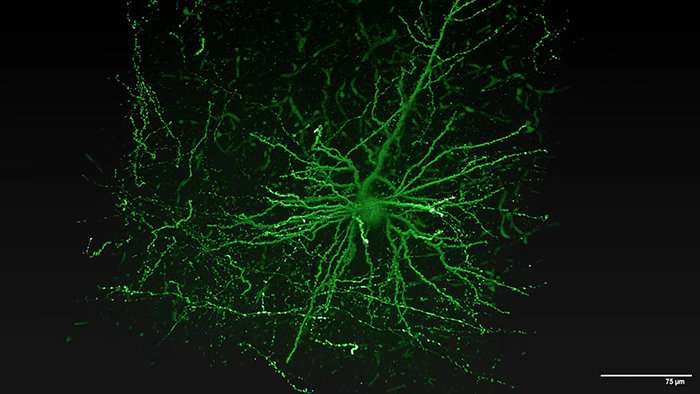 300 neurons traced in extensive brain wiring map