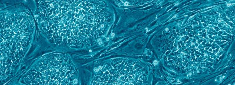Researchers reveal how stem cells make decisions