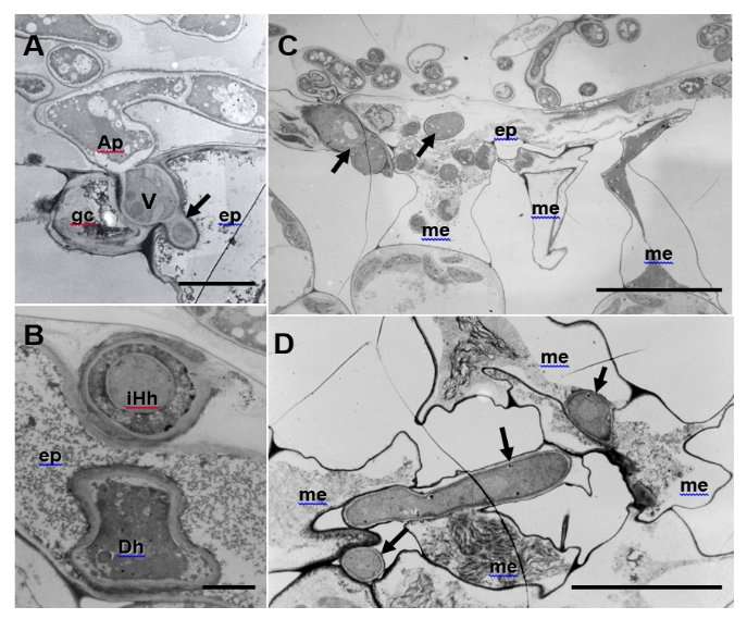 Aberrant hyphae triggered by host immune responses to plant pathogenic fungus