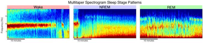 Advanced EEG analysis reveals the complex beauty of the sleeping brain