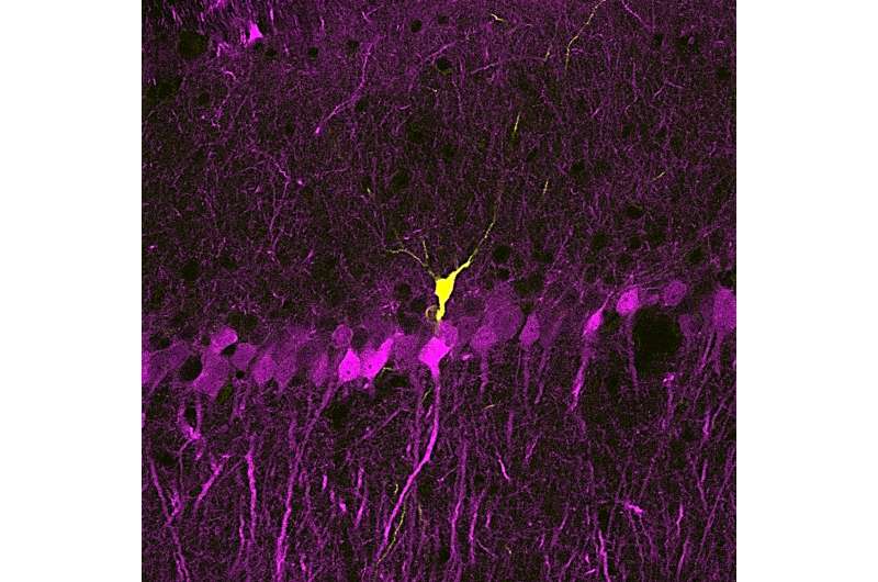 A new technique isolates neuronal activity during memory consolidation