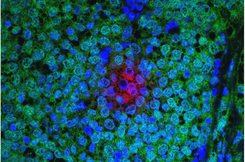 Cancer cells send signals boosting survival and drug resistance in other cancer cells