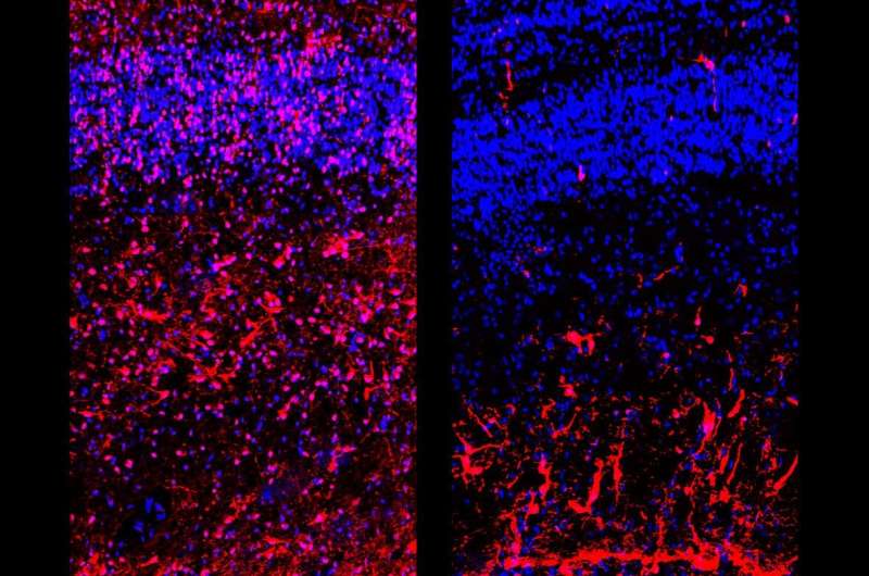 Chicken embryo illuminates role of thyroid hormone in brain development