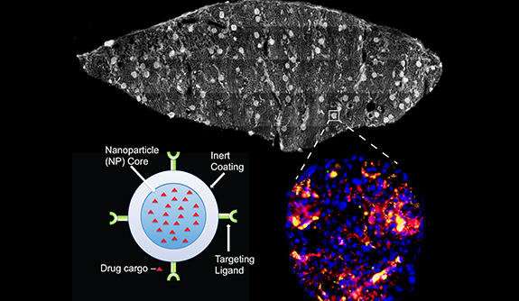 Combining machine and nanoparticles for better transplant outcome