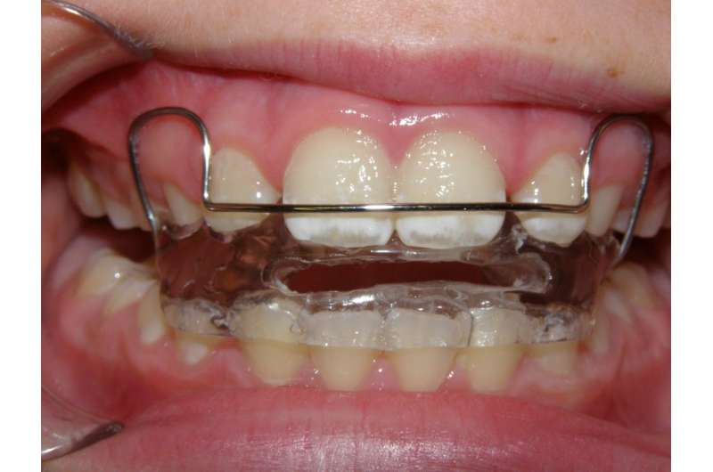 Difficult to get orthodontics to work in younger children