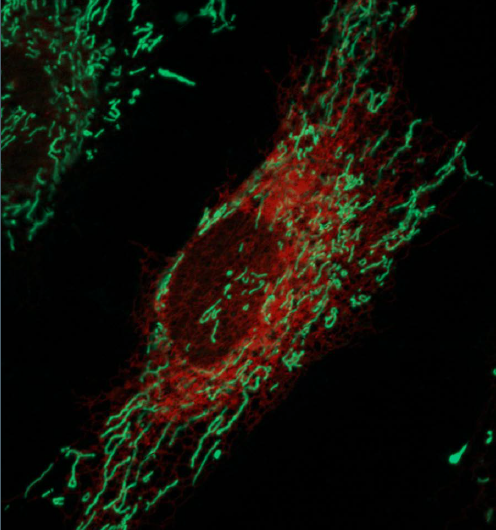 Discovering what makes organelles connect could help understand neurodegenerative diseases