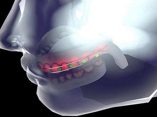 Flexible batteries a highlight for smart dental aids