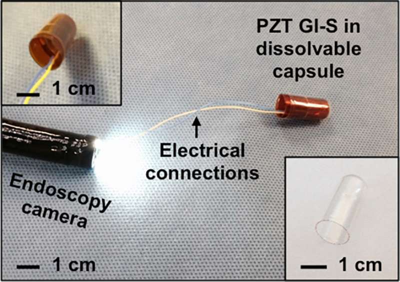 Flexible sensors can detect movement in GI tract