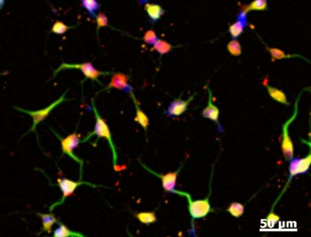 From skin to brain: Stem cells without genetic modification