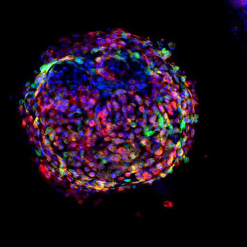 Interrupted reprogramming converts adult cells into high yields of progenitor-like cells