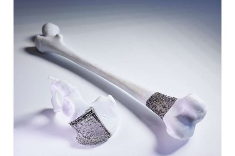 Just-in-time 3-D implants set to transform tumor surgery