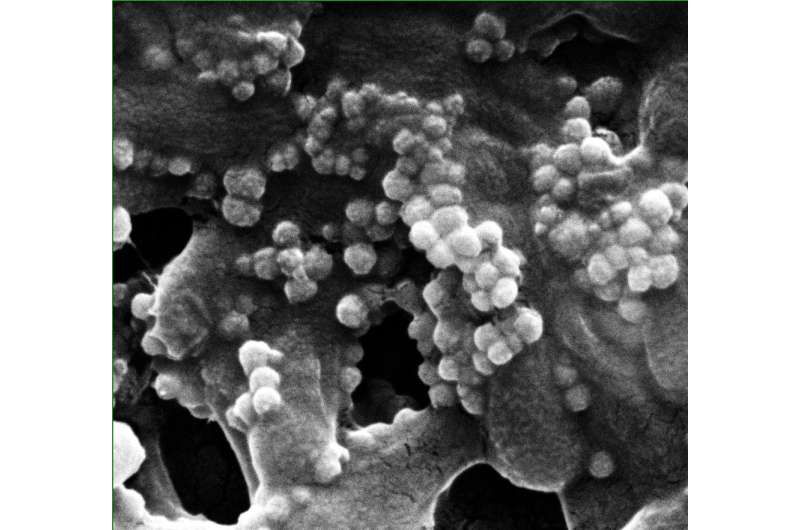 Magnetized viruses attack harmful bacteria