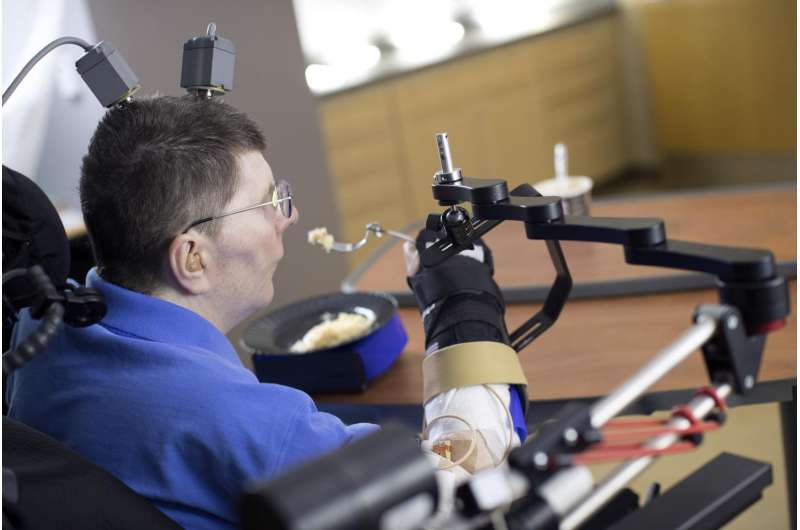 Man with quadriplegia employs injury bridging technologies to move again -- just by thinking