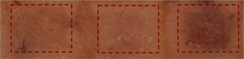 Mass. General-led study replicates tanning response in cultured human skin