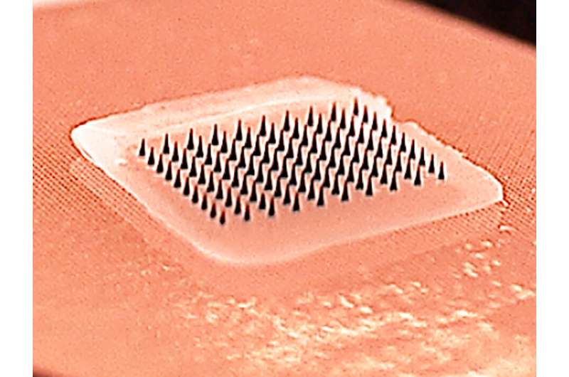 Microneedle patches for flu vaccination prove successful in first human clinical trial