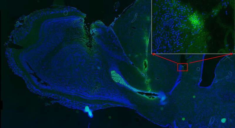 Neural stem cells steered by electric fields in rat brain