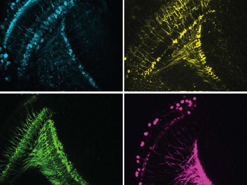 Neurobiologists discover important characteristics of the motion detector in the fly brain