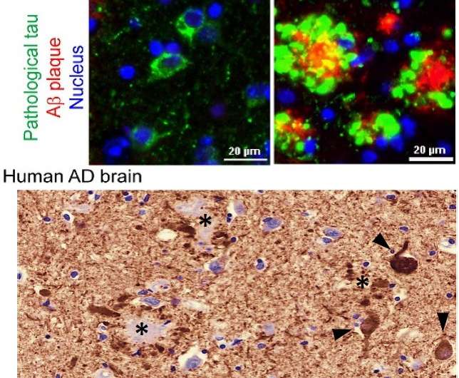 New Alzheimer's animal model more closely mimics human disease