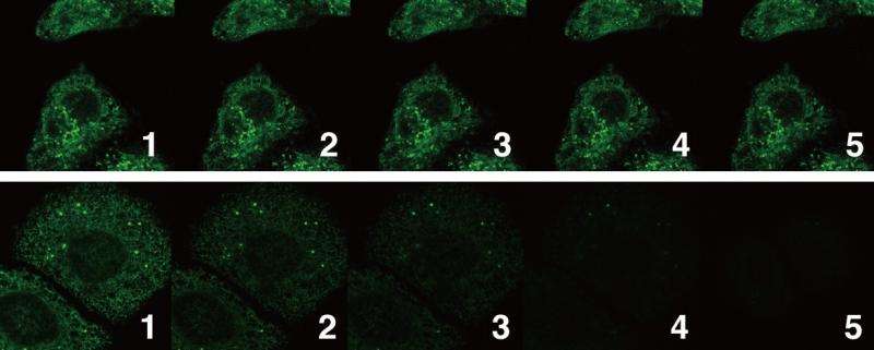 New dye allows super-imaging of cells