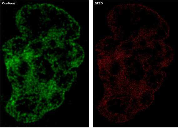 New super-resolution probe captures cells in unprecedented detail