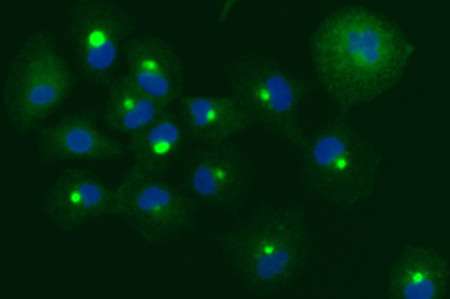 New treatment causes cancer cells to fill up with cellular "trash" and self-destruct