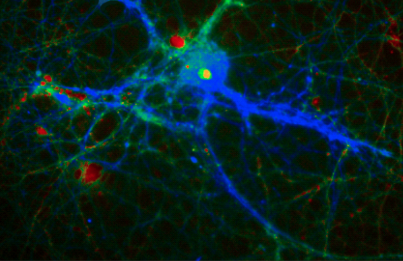 Novel protein interactions explain memory deficits in Parkinson's disease