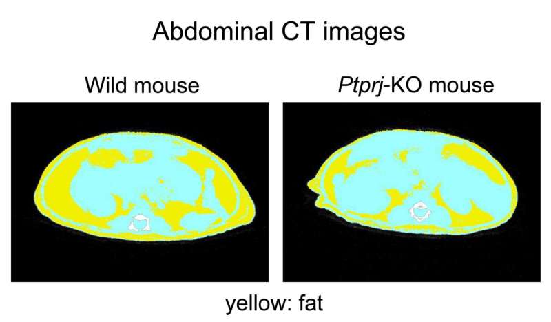 Obese inducing brain mechanism