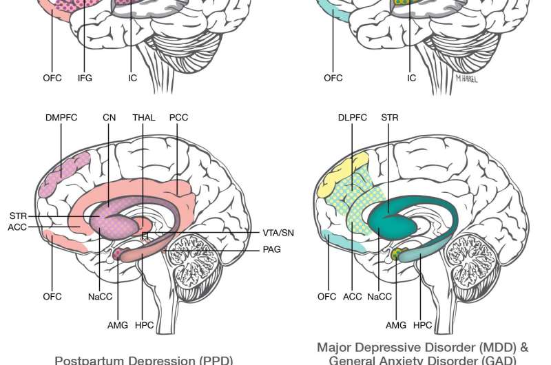Postpartum depression &amp; anxiety distinct from other mood disorders, brain studies suggest