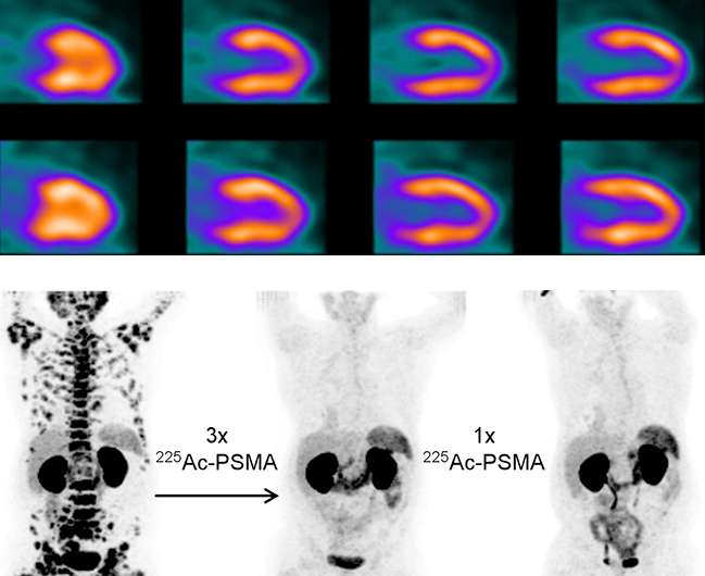 Producing radioisotopes for medical imaging and disease treatment