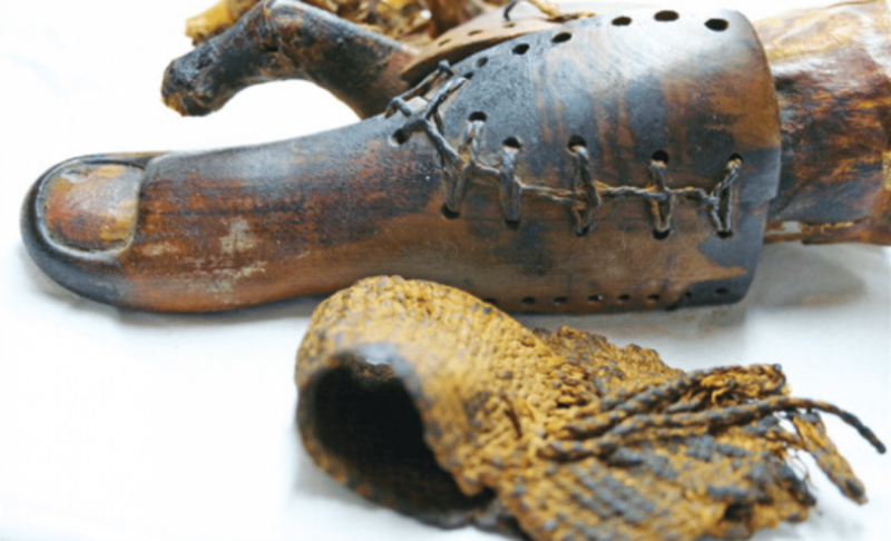 Severed limbs and wooden feet—how the ancients invented prosthetics