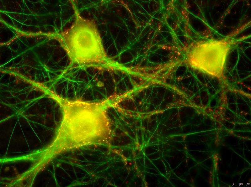 Stem cells derived neuronal networks grown on a chip as an alternative to animal testing