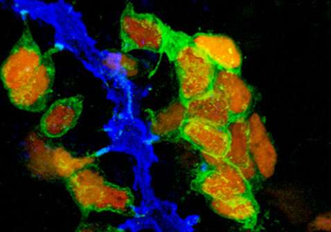 Stem cells pave the way for new treatment of diabetes