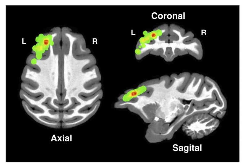 Study illustrates how the cortex assigns credit for causality