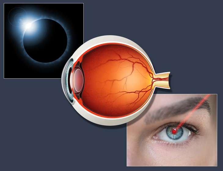 The Medical Minute: Solar eclipses and laser pointers pose similar eye hazards