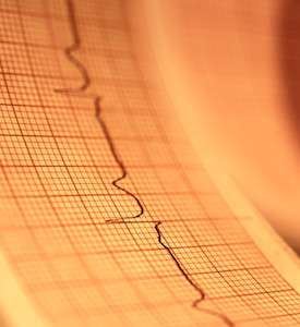 These 5 tests better predict heart disease risk