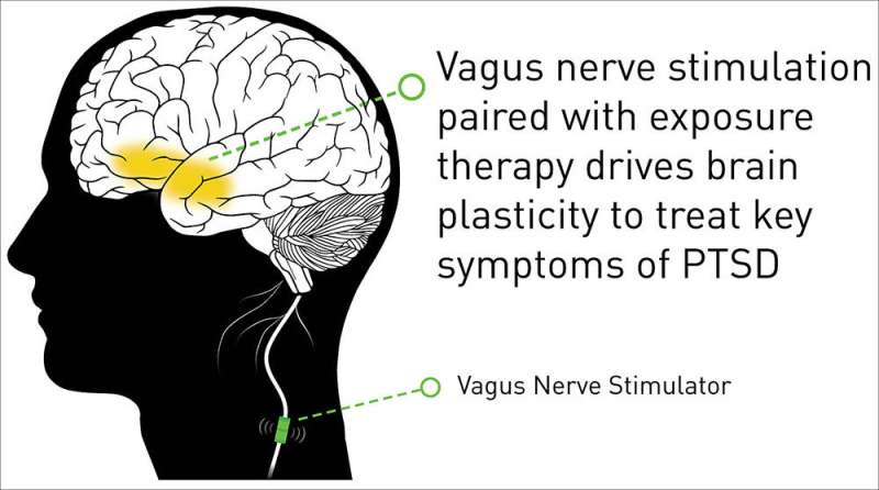Vagus nerve stimulation therapy shows progress in battling PTSD symptoms
