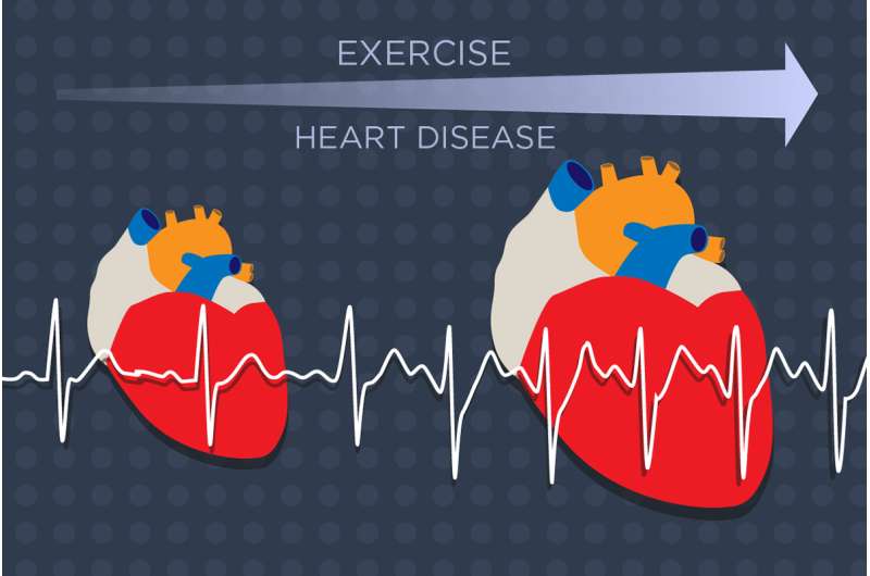 Study identifies key player in heart enlargement