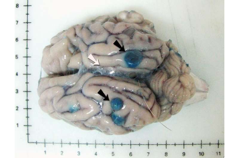 New treatment investigated for brain tapeworm infection